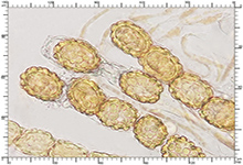 Genea hispidula